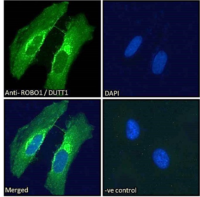 ROBO1 Antibody - Goat Anti-ROBO1 / DUTT1 (Internal) Antibody Immunofluorescence analysis of paraformaldehyde fixed HeLa cells, permeabilized with 0.15% Triton. Primary incubation 1hr (10ug/ml) followed by Alexa Fluor 488 secondary antibody (2ug/ml), showing Golgi and membrane staining. The nuclear stain is DAPI (blue). Negative control: Unimmunized goat IgG (10ug/ml) followed by Alexa Fluor 488 secondary antibody (2ug/ml).