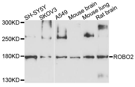 ROBO2 Antibody - Western blot analysis of extracts of various cell lines, using ROBO2 antibody at 1:1000 dilution. The secondary antibody used was an HRP Goat Anti-Rabbit IgG (H+L) at 1:10000 dilution. Lysates were loaded 25ug per lane and 3% nonfat dry milk in TBST was used for blocking. An ECL Kit was used for detection and the exposure time was 90s.