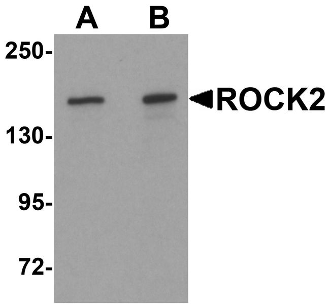 ROCK2 Antibody - Western blot analysis of ROCK2 in mouse brain tissue lysate with ROCK2 antibody at (A) 1 and (B) 2 ug/ml