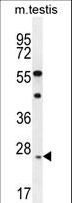 ROPN1L Antibody - ROPN1L Antibody western blot of mouse testis tissue lysates (35 ug/lane). The ROPN1L antibody detected the ROPN1L protein (arrow).