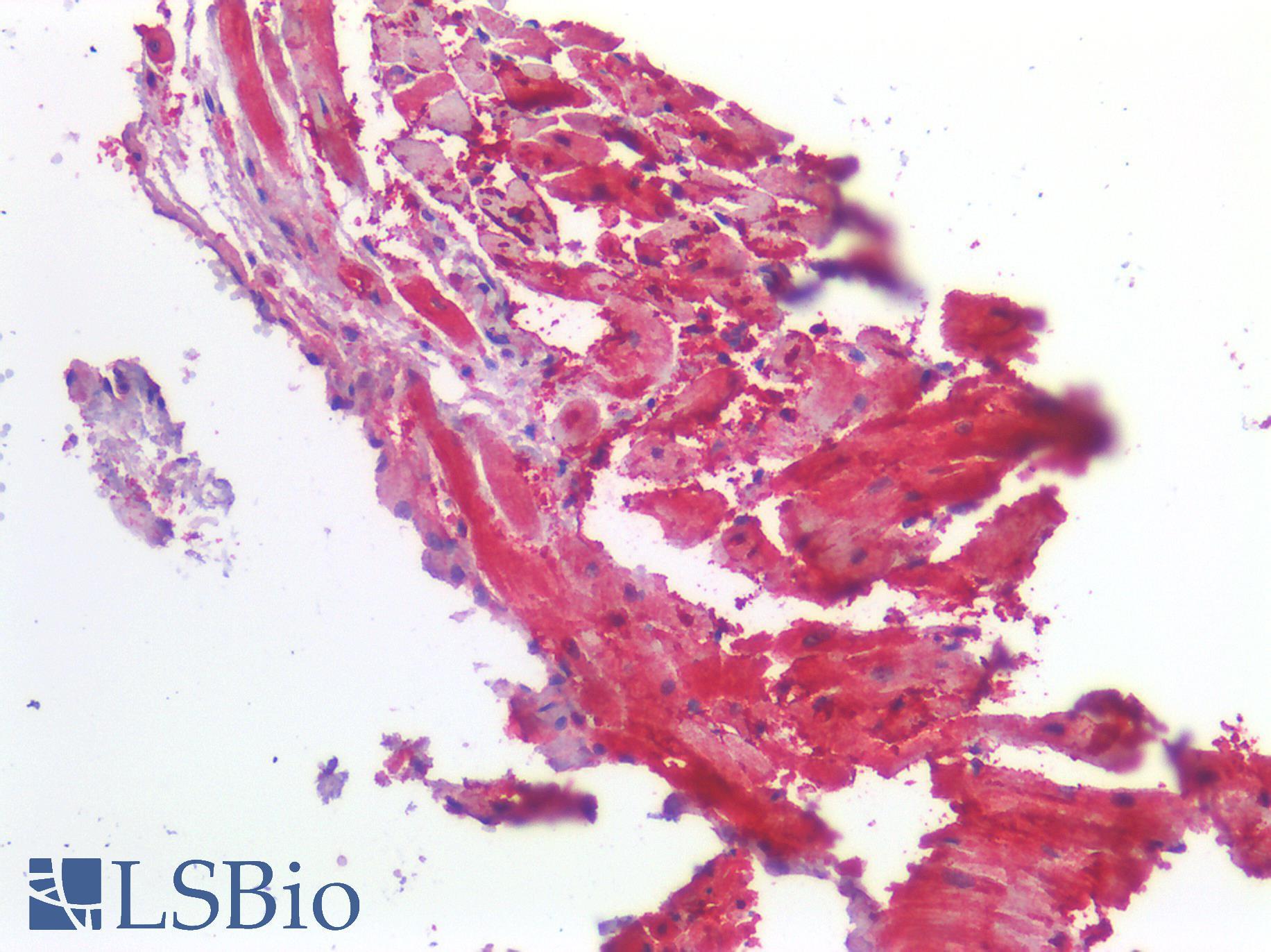 ROR1 Antibody - Human Heart: Formalin-Fixed, Paraffin-Embedded (FFPE)