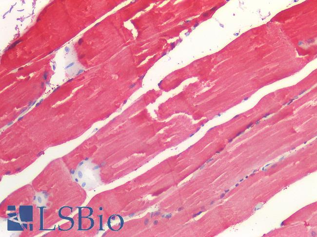 ROR1 Antibody - Human Skeletal Muscle: Formalin-Fixed, Paraffin-Embedded (FFPE)