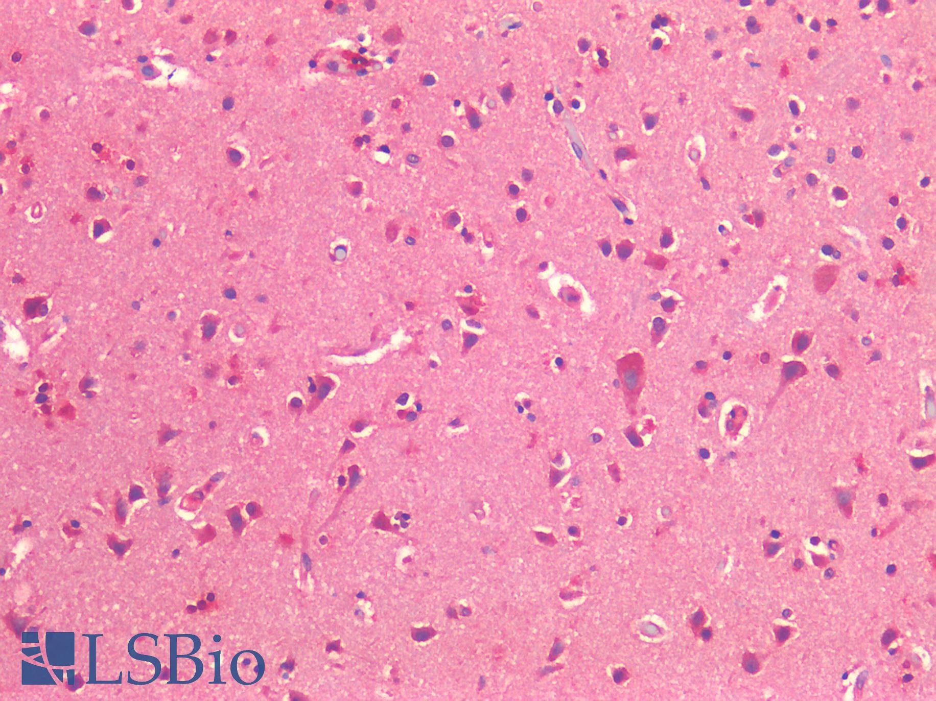 ROR1 Antibody - Human Brain, Cortex: Formalin-Fixed, Paraffin-Embedded (FFPE)