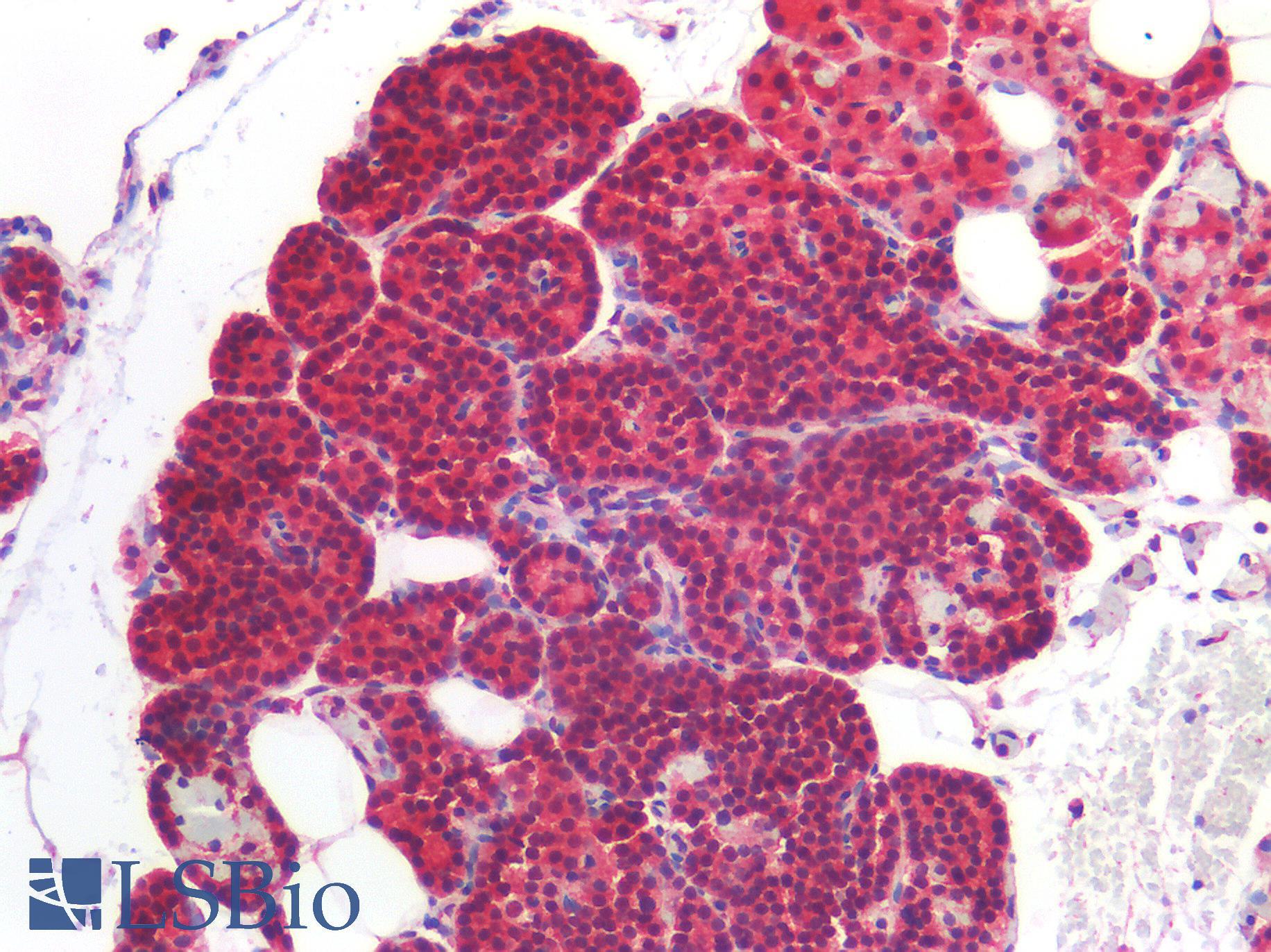 ROR1 Antibody - Human Parathyroid: Formalin-Fixed, Paraffin-Embedded (FFPE)