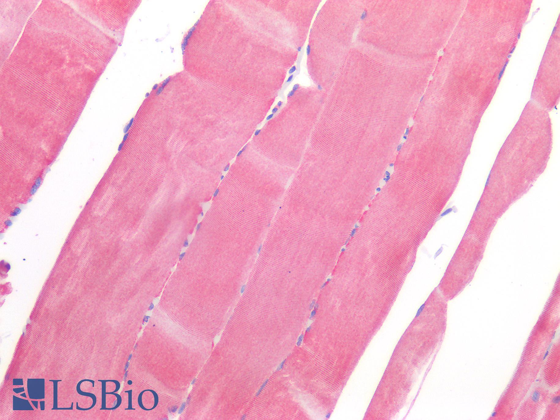 ROR1 Antibody - Human Skeletal Muscle: Formalin-Fixed, Paraffin-Embedded (FFPE)