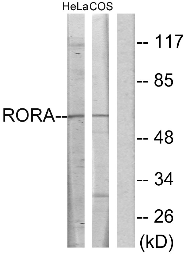 RORA / ROR Alpha Antibody - Western blot analysis of lysates from HeLa and COS7 cells, using RORA Antibody. The lane on the right is blocked with the synthesized peptide.