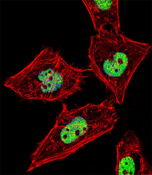 RORA / ROR Alpha Antibody - Fluorescent confocal image of HeLa cell stained with RORA Antibody (T216). HeLa cells were fixed with 4% PFA (20 min), permeabilized with Triton X-100 (0.1%, 10 min), then incubated with RORA primary antibody (1:25, 1 h at 37°C). For secondary antibody, Alexa Fluor 488 conjugated donkey anti-rabbit antibody (green) was used (1:400, 50 min at 37°C). Cytoplasmic actin was counterstained with Alexa Fluor 555 (red) conjugated Phalloidin (7units/ml, 1 h at 37°C). Nuclei were counterstained with DAPI (blue) (10 ug/ml, 10 min). RORA immunoreactivity is localized to Nucleus significantly.
