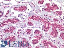 RORC / ROR Gamma Antibody - Human Breast: Formalin-Fixed, Paraffin-Embedded (FFPE)