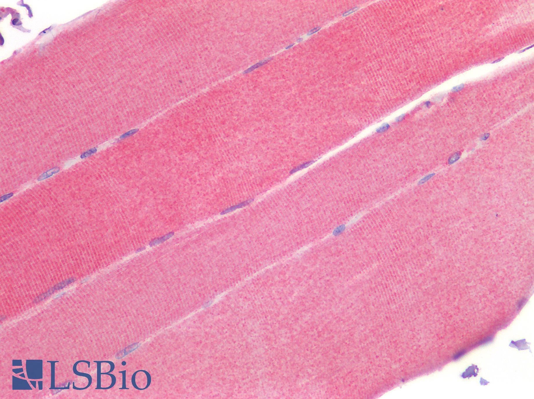 RORC / ROR Gamma Antibody - Human Skeletal Muscle: Formalin-Fixed, Paraffin-Embedded (FFPE)