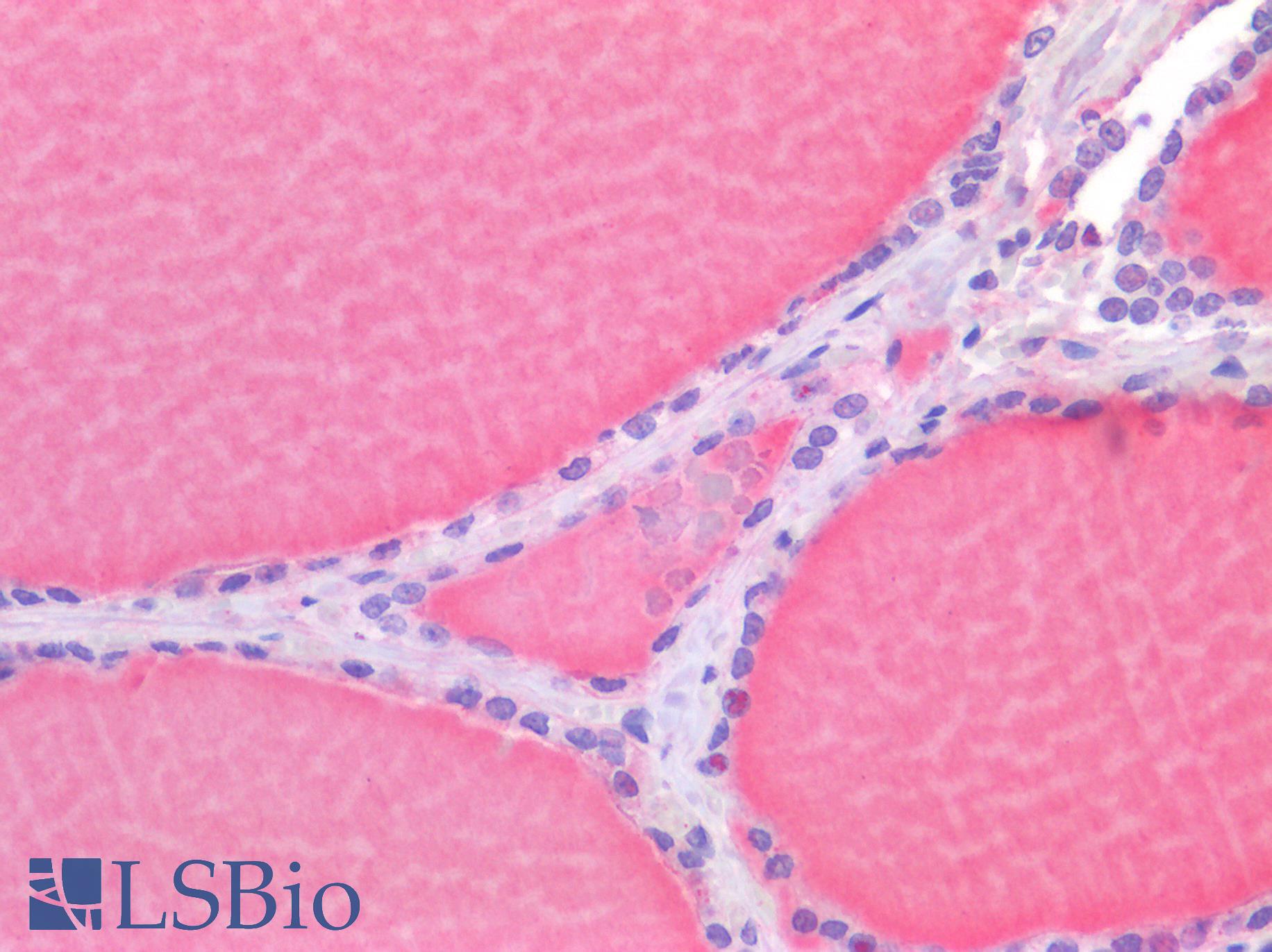 RORC / ROR Gamma Antibody - Human Thyroid: Formalin-Fixed, Paraffin-Embedded (FFPE)