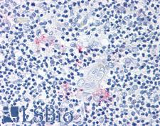 RORC / ROR Gamma Antibody - Anti-ROR Gamma antibody IHC of human thymus. Immunohistochemistry of formalin-fixed, paraffin-embedded tissue after heat-induced antigen retrieval.