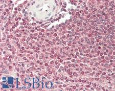 RP105 / CD180 Antibody - Human Spleen: Formalin-Fixed, Paraffin-Embedded (FFPE)