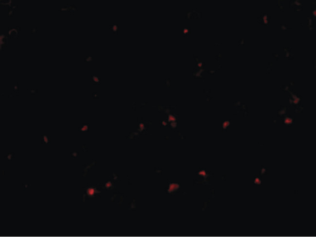 RP105 / CD180 Antibody - Immunofluorescence of RP105 in human spleen tissue with RP105 antibody at 20 ug/ml.