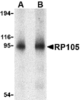 RP105 / CD180 Antibody - Western blot of RP105 in human spleen tissue lysate with RP105 antibody at (A) 0.5 and (B) 1 ug/ml.