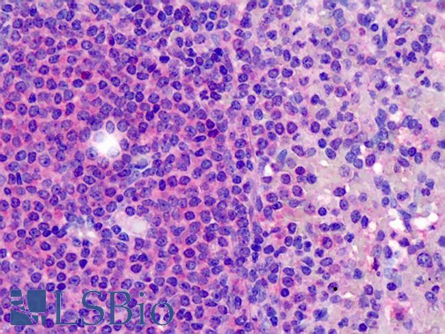 RP105 / CD180 Antibody - Anti-CD180 / RP105 antibody IHC of human tonsil. Immunohistochemistry of formalin-fixed, paraffin-embedded tissue after heat-induced antigen retrieval. Antibody concentration 5 ug/ml.