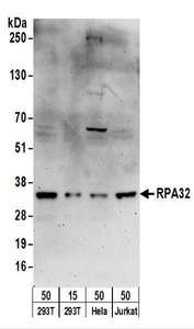 RPA2 / RFA2 / RPA34 Antibody - Detection of Human RPA32 by Western Blot. Samples: Whole cell lysate from 293T (15 and 50 ug), HeLa (50 ug), and Jurkat (50 ug) cells. Antibodies: Affinity purified goat anti-RPA32 antibody used for WB at 1 ug/ml. Detection: Chemiluminescence with an exposure time of 3 minutes.