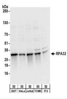 RPA2 / RFA2 / RPA34 Antibody - Detection of Human and Mouse RPA32 by Western Blot. Samples: Whole cell lysate (50 ug) from 293T, HeLa, Jurkat, mouse TCMK-1, and mouse NIH3T3 cells. Antibodies: Affinity purified rabbit anti-RPA32 antibody used for WB at 1 ug/ml. Detection: Chemiluminescence with an exposure time of 3 seconds.