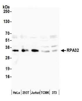RPA2 / RFA2 / RPA34 Antibody - Detection of human and mouse RPA32 by western blot. Samples: Whole cell lysate (5 µg) from HeLa, HEK293T, Jurkat, mouse TCMK-1, and mouse NIH 3T3 cells prepared using NETN lysis buffer. Antibody: Affinity purified rabbit anti-RPA32 antibody used for WB at 0.1 µg/ml. Detection: Chemiluminescence with an exposure time of 10 seconds.