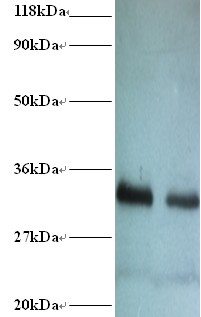 RPA2 / RFA2 / RPA34 Antibody - Western blot of Replication protein A 32 kDa subunit antibody at 2 ug/ml. Lane 1: EC109 whole cell lysate. Lane 2: 293T whole cell lysate. Secondary: Goat polyclonal to Rabbit IgG at 1:15000 dilution. Predicted band size:32 kDa. Observed band size: 32 kDa Additional bands at: 26 kDa. We are unsure as to the identity of this extra band.  This image was taken for the unconjugated form of this product. Other forms have not been tested.