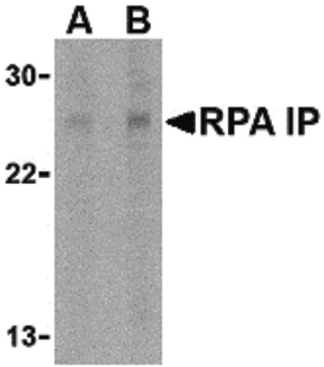 RPAIN Antibody - Western blot of RPA Interacting Protein in Jurkat cell lysate with RPA Interacting Protein antibody at (A) 1 and (B) 2 ug/ml.