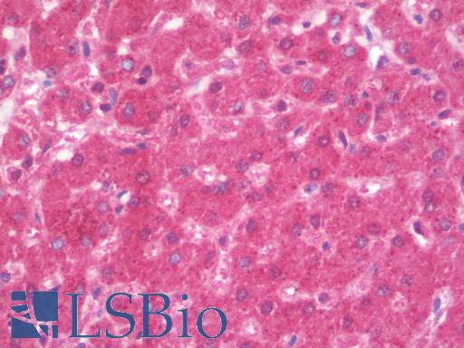 RPL12 / Ribosomal Protein L12 Antibody - Anti-RPL12 antibody IHC staining of human liver, vessel endothelium. Immunohistochemistry of formalin-fixed, paraffin-embedded tissue after heat-induced antigen retrieval. Antibody dilution 1:100.