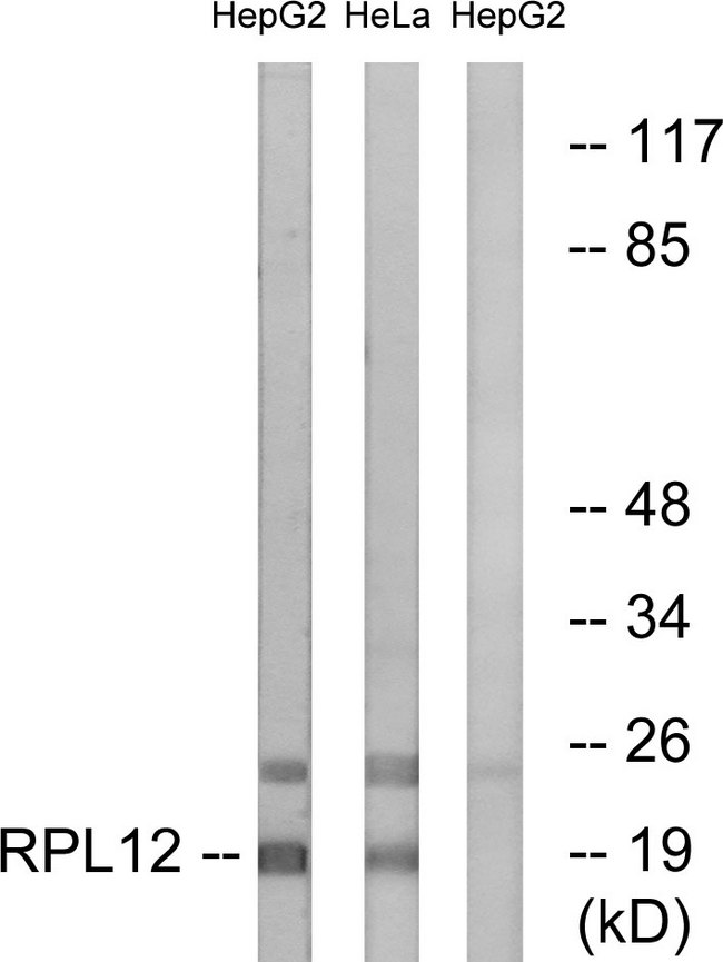 RPL12 / Ribosomal Protein L12 Antibody - Western blot analysis of lysates from HepG2 and HeLa cells, using RPL12 Antibody. The lane on the right is blocked with the synthesized peptide.