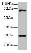 RPL17 / Ribosomal Protein L17 Antibody - Western blot All lanes: 60S ribosomal protein L17 antibody at 2µg/ml + EC109whole cell lysate Secondary Goat polyclonal to rabbit IgG at 1/15000 dilution Predicted band size: 22, 18, 27 kDa Observed band size: 27, 80 kDa