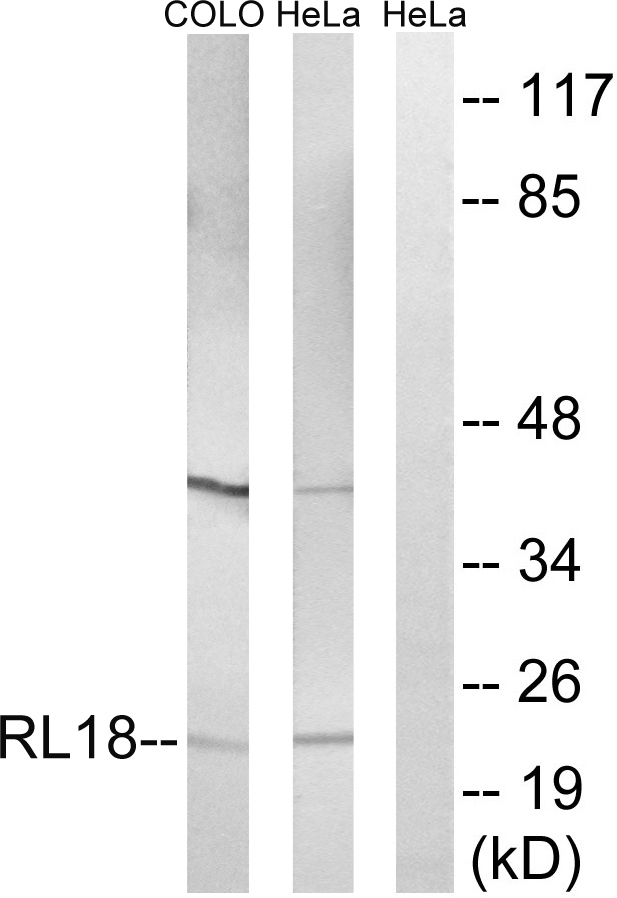 RPL18 / Ribosomal Protein L18 Antibody - Western blot analysis of lysates from HeLa and COLO cells, using RPL18 Antibody. The lane on the right is blocked with the synthesized peptide.