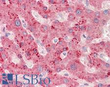 RPL23 / Ribosomal Protein L23 Antibody - Anti-RPL23 / L23 antibody IHC staining of human liver. Immunohistochemistry of formalin-fixed, paraffin-embedded tissue after heat-induced antigen retrieval. Antibody concentration 5 ug/ml.