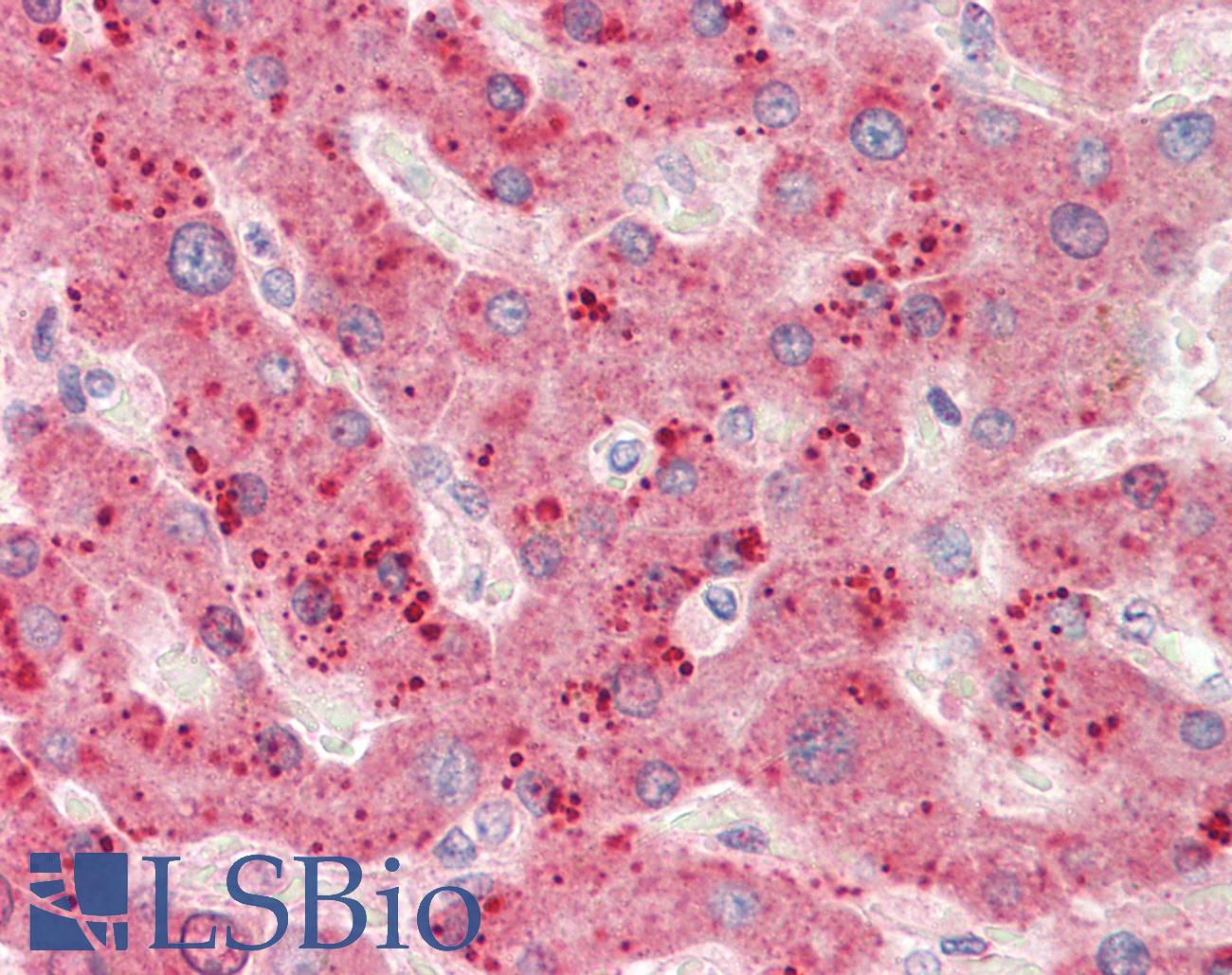 RPL23 / Ribosomal Protein L23 Antibody - Anti-RPL23 / L23 antibody IHC staining of human liver. Immunohistochemistry of formalin-fixed, paraffin-embedded tissue after heat-induced antigen retrieval. Antibody concentration 5 ug/ml.