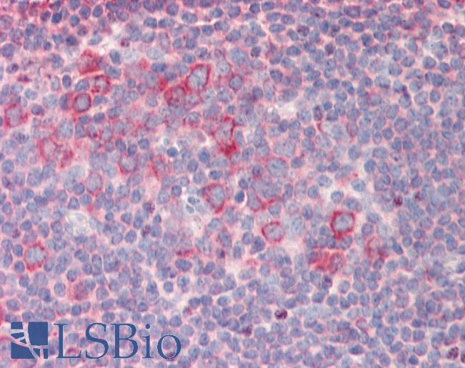 RPL23 / Ribosomal Protein L23 Antibody - Anti-RPL23 / L23 antibody IHC staining of human tonsil. Immunohistochemistry of formalin-fixed, paraffin-embedded tissue after heat-induced antigen retrieval.