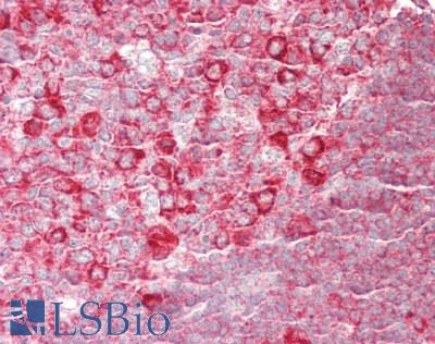 RPL26 / Ribosomal Protein L26 Antibody - Human Tonsil: Formalin-Fixed, Paraffin-Embedded (FFPE)