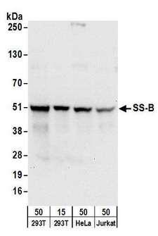 RPL26 / Ribosomal Protein L26 Antibody - Detection of human SS-B by western blot. Samples: Whole cell lysate from HEK293T (15 and 50 µg), HeLa (50µg), and Jurkat (50µg) cells. Antibodies: Affinity purified rabbit anti-SS-B antibody used for WB at 0.1 µg/ml. Detection: Chemiluminescence with an exposure time of 10 seconds.