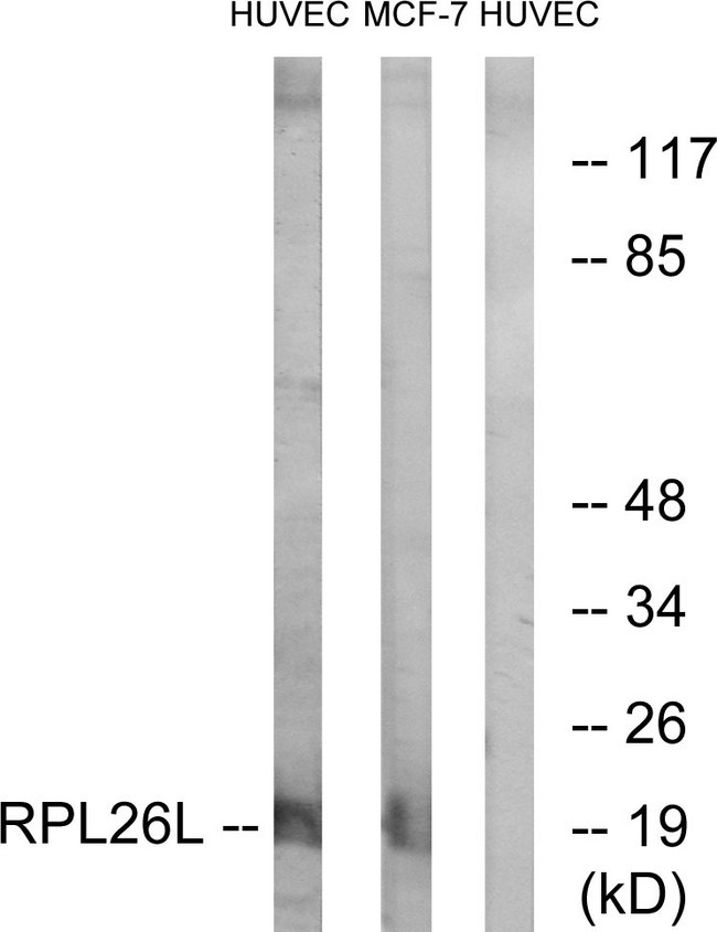 RPL26L1 Antibody - Western blot analysis of lysates from HUVEC and MCF-7 cells, using RPL26L Antibody. The lane on the right is blocked with the synthesized peptide.