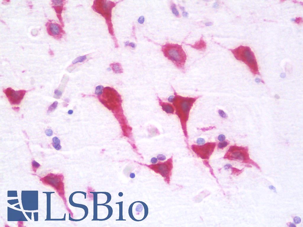 RPL28 / Ribosomal Protein L28 Antibody - Anti-RPL28 antibody IHC staining of human brain, cortex. Immunohistochemistry of formalin-fixed, paraffin-embedded tissue after heat-induced antigen retrieval. Antibody dilution 1:100.