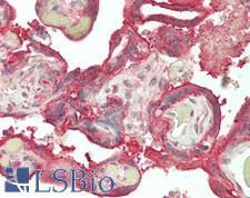 RPL3 / Ribosomal Protein L3 Antibody - Human Placenta: Formalin-Fixed, Paraffin-Embedded (FFPE)