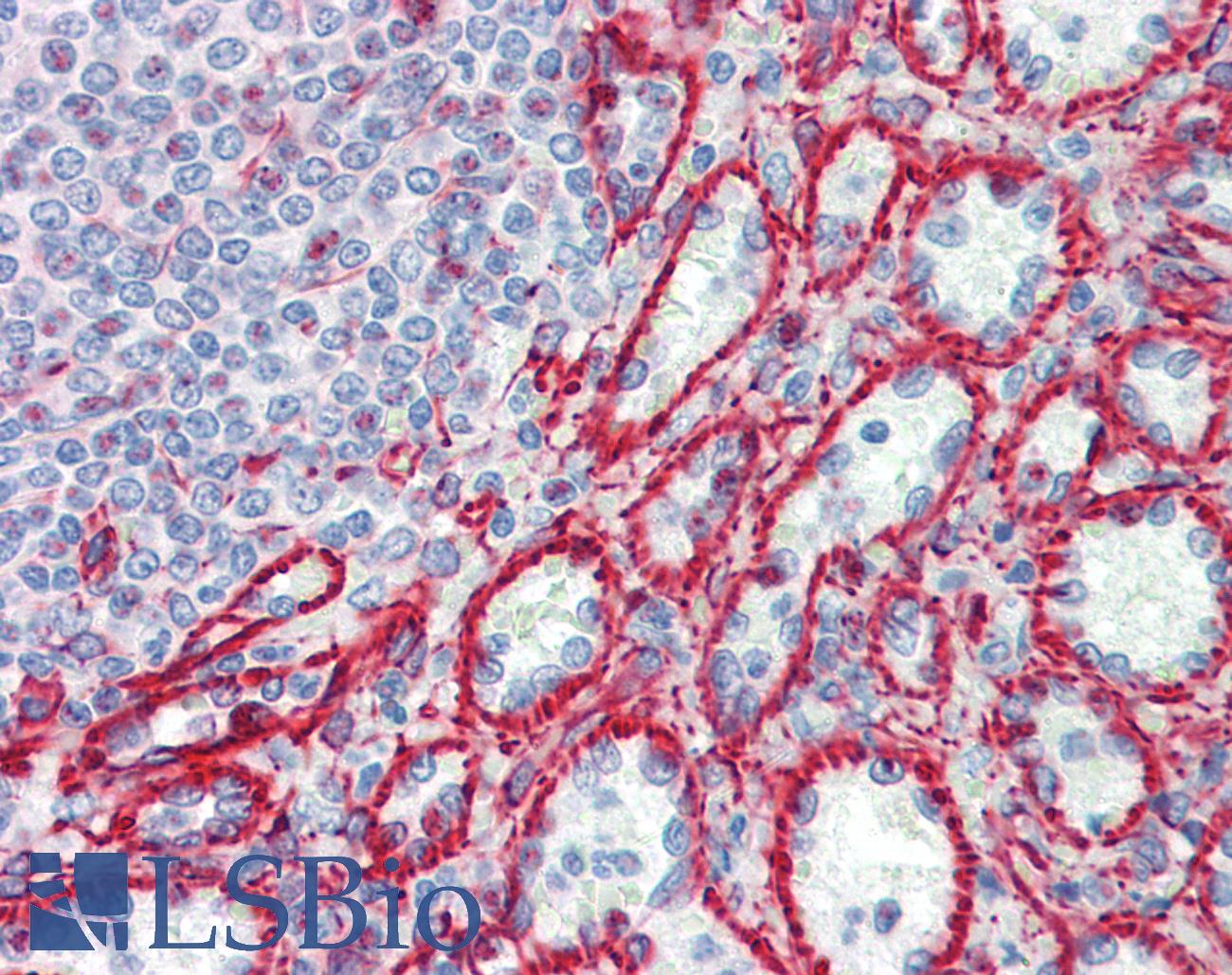 RPL30 / Ribosomal Protein L30 Antibody - Anti-RPL30 antibody IHC staining of human spleen. Immunohistochemistry of formalin-fixed, paraffin-embedded tissue after heat-induced antigen retrieval. Antibody dilution 1:100.