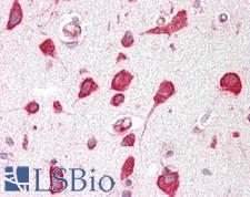 RPL30 / Ribosomal Protein L30 Antibody - Human Brain, Cortex: Formalin-Fixed, Paraffin-Embedded (FFPE)