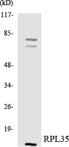 RPL35 / Ribosomal Protein L35 Antibody - Western blot analysis of the lysates from HeLa cells using RPL35 antibody.
