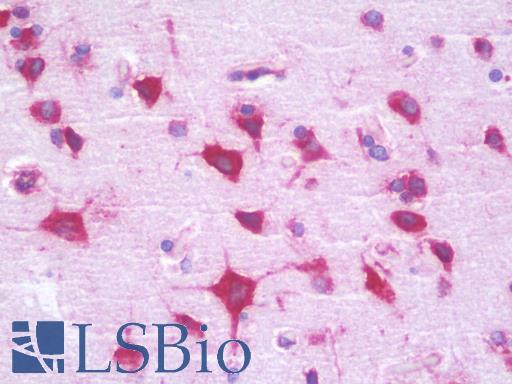 RPL35 / Ribosomal Protein L35 Antibody - Anti-RPL35 antibody IHC staining of human brain, cortex. Immunohistochemistry of formalin-fixed, paraffin-embedded tissue after heat-induced antigen retrieval. Antibody dilution 1:100.