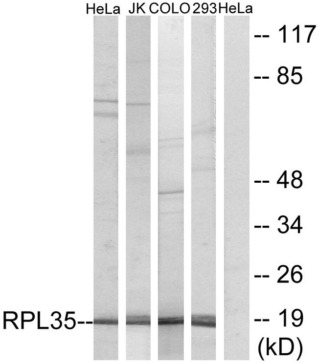 RPL35 / Ribosomal Protein L35 Antibody - Western blot analysis of lysates from 293, HeLa, COLO, and Jurkat cells, using RPL35 Antibody. The lane on the right is blocked with the synthesized peptide.