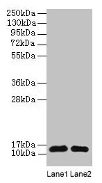 RPL36AL Antibody - Western blot All lanes: 60S ribosomal protein L36a-like antibody at 2µg/ml Lane 1: EC109whole cell lysate Lane 2: 293T whole cell lysate Secondary Goat polyclonal to rabbit IgG at 1/15000 dilution Predicted band size: 12 kDa Observed band size: 12 kDa