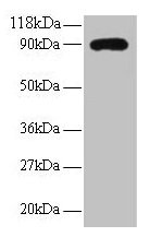 RPL38 / Ribosomal Protein L38 Antibody - Western blot 60S ribosomal protein L38 antibody at 2µg/ml + EC109 whole cell lysate at 20Secondary Goat polyclonal to rabbit IgG at 1/15000 dilution Predicted band size: 7.7 kDa Observed band size: 90 kDa