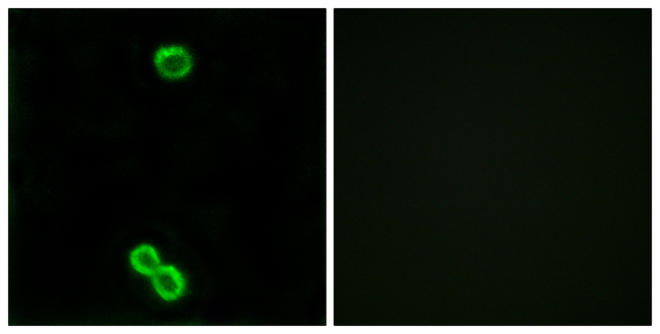 RPL3L Antibody - Immunofluorescence analysis of MCF7 cells, using RPL3L Antibody. The picture on the right is blocked with the synthesized peptide.