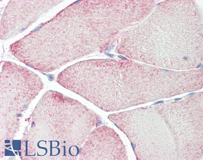 RPL3L Antibody - Anti-RPL3L antibody IHC of human skeletal muscle. Immunohistochemistry of formalin-fixed, paraffin-embedded tissue after heat-induced antigen retrieval. Antibody dilution 10 ug/ml.