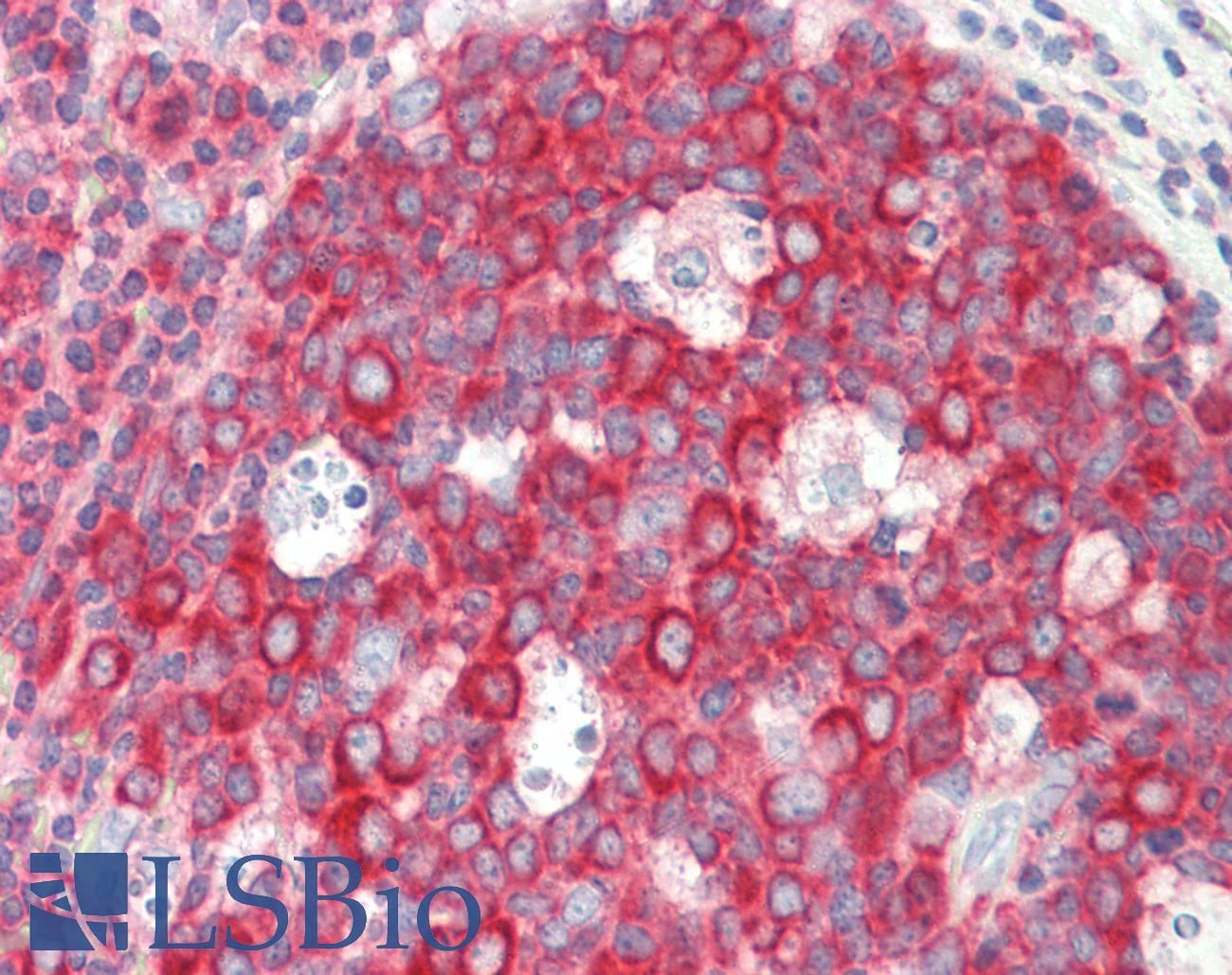 RPL4 / Ribosomal Protein L4 Antibody - Anti-RPL4 / L4 antibody IHC staining of human tonsil. Immunohistochemistry of formalin-fixed, paraffin-embedded tissue after heat-induced antigen retrieval. Antibody concentration 10 ug/ml.
