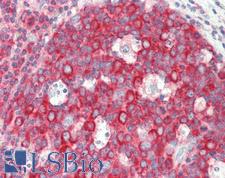 RPL4 / Ribosomal Protein L4 Antibody - Anti-RPL4 / L4 antibody IHC staining of human tonsil. Immunohistochemistry of formalin-fixed, paraffin-embedded tissue after heat-induced antigen retrieval. Antibody concentration 10 ug/ml.
