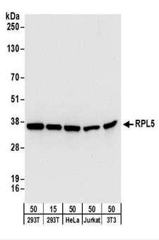 RPL5 / Ribosomal Protein L5 Antibody - Detection of Human and Mouse RPL5 by Western Blot. Samples: Whole cell lysate from 293T (15 and 50 ug), HeLa (50 ug), Jurkat (50 ug), and mouse NIH3T3 (50 ug) cells. Antibodies: Affinity purified rabbit anti-RPL5 antibody used for WB at 0.1 ug/ml. Detection: Chemiluminescence with an exposure time of 10 seconds.