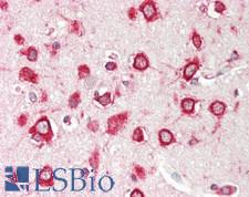 RPL5 / Ribosomal Protein L5 Antibody - Human Brain, Cortex: Formalin-Fixed, Paraffin-Embedded (FFPE)