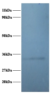 RPL5 / Ribosomal Protein L5 Antibody - Western blot of 60S ribosomal protein L5 polyclonal Antibody at 2 ug/ml + EC109 whole cell lysate at 20 ug. Secondary: Goat polyclonal to Rabbit IgG at 1:15000 dilution. Predicted band size: 32.7 kDa. Observed band size: 32.7 kDa.  This image was taken for the unconjugated form of this product. Other forms have not been tested.